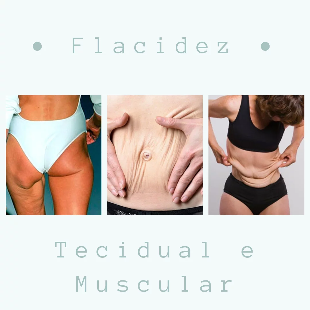 flacidez muscular e tecidual comparação visual